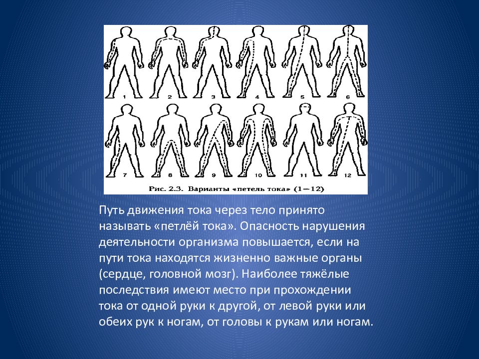 Токов путь. Варианты петель тока. Петля путь тока. Петля электрического тока. Как проходит ток через человека.