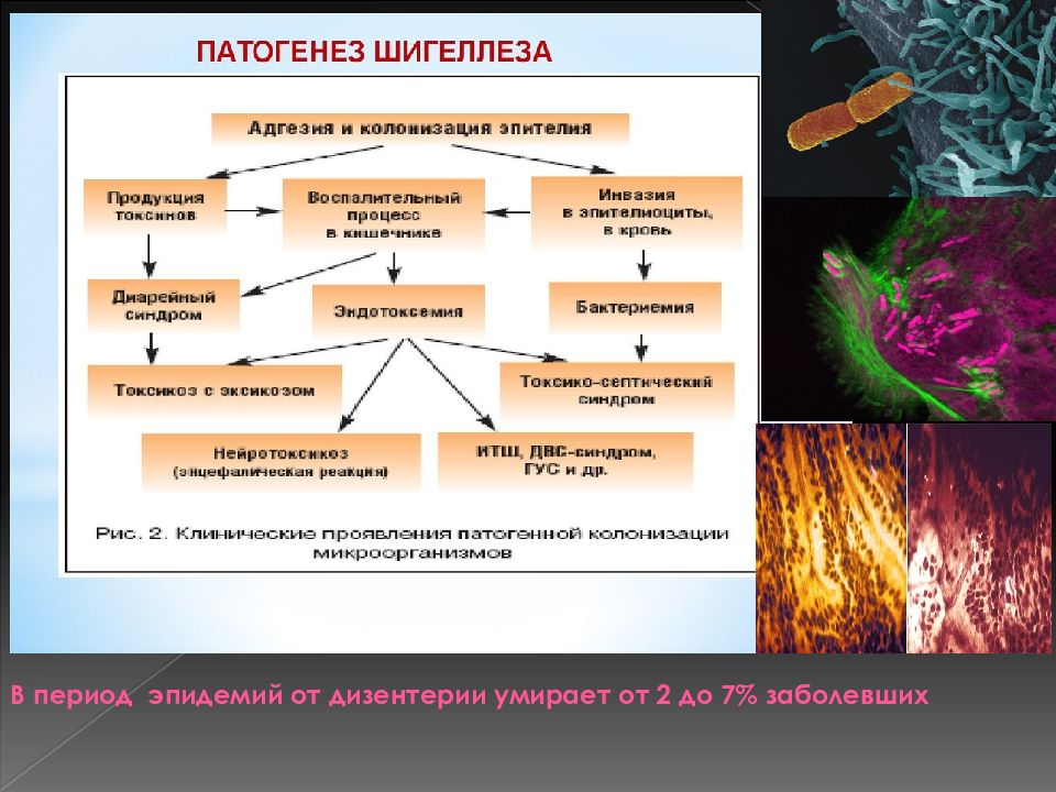 Патогенез дизентерии схема