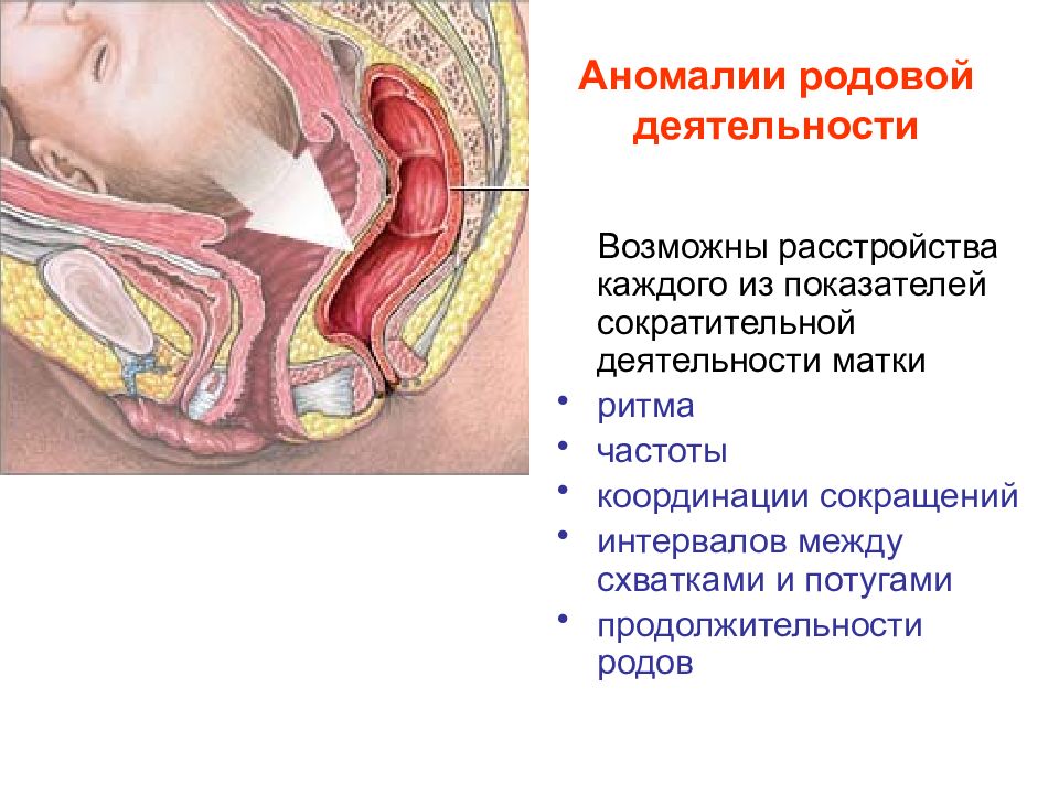 Аномалии родовой деятельности картинки