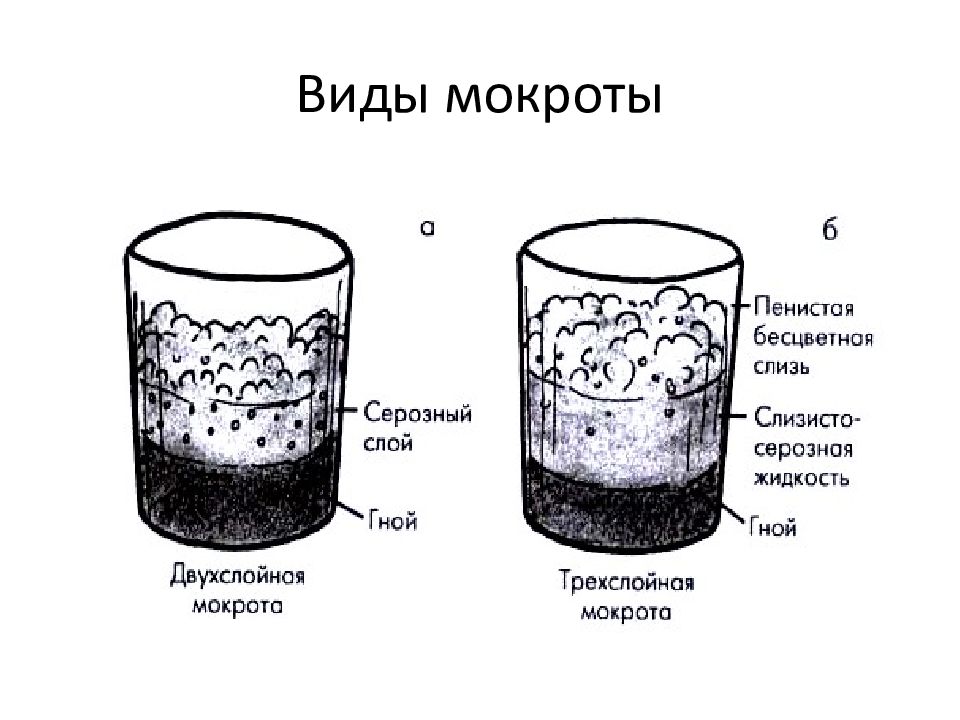 Цвет мокроты картинки