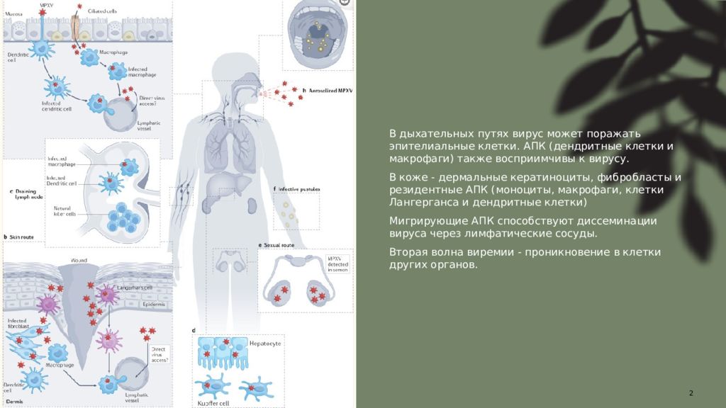 Оспа обезьян презентация