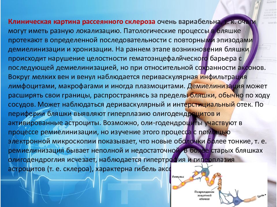 Шашыранды склероз презентация