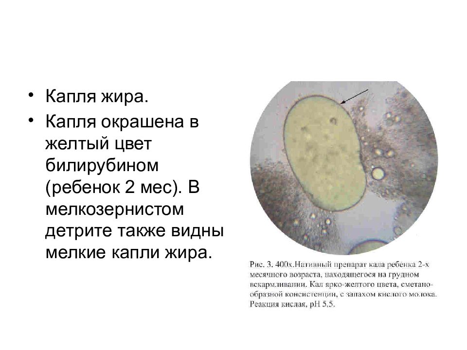 Жир в желчи рисунок