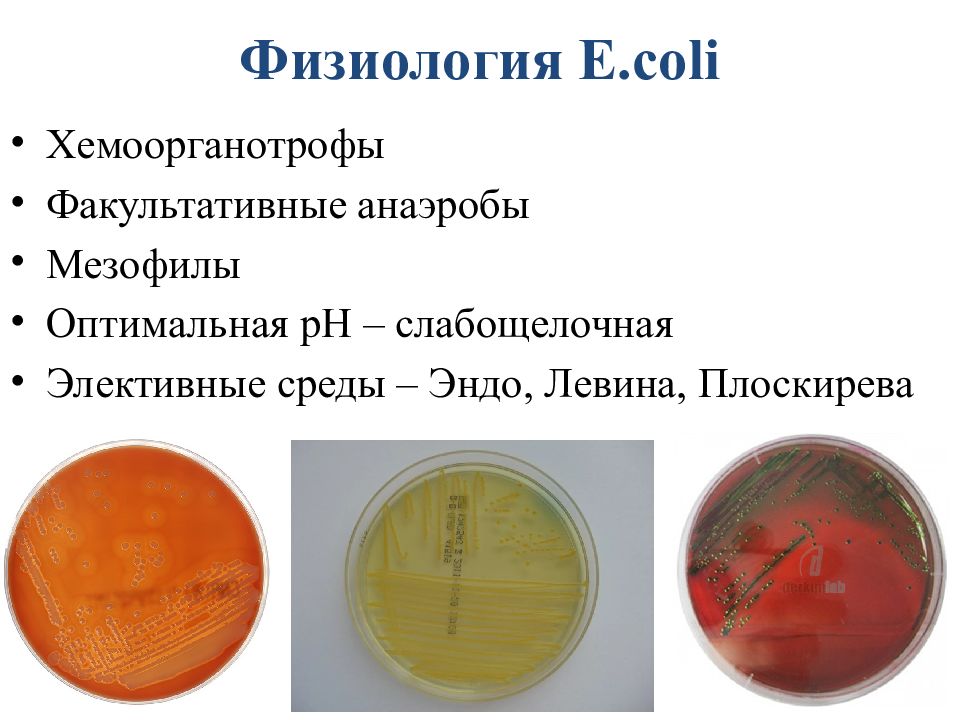 Кишечная палочка презентация микробиология