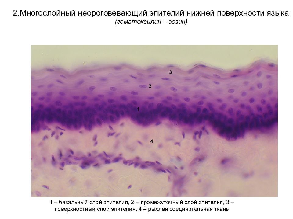 Многослойный неороговевающий эпителий рисунок