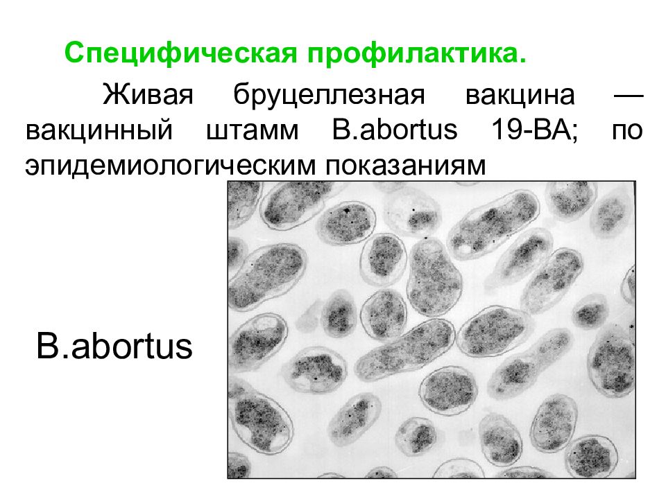 Чума 51. Живая бруцеллезная вакцина. Чума специфическая профилактика. Специфическую профилактику чумы проводят.