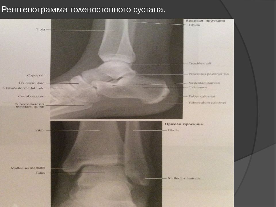 Резаная рана голеностопного сустава карта вызова