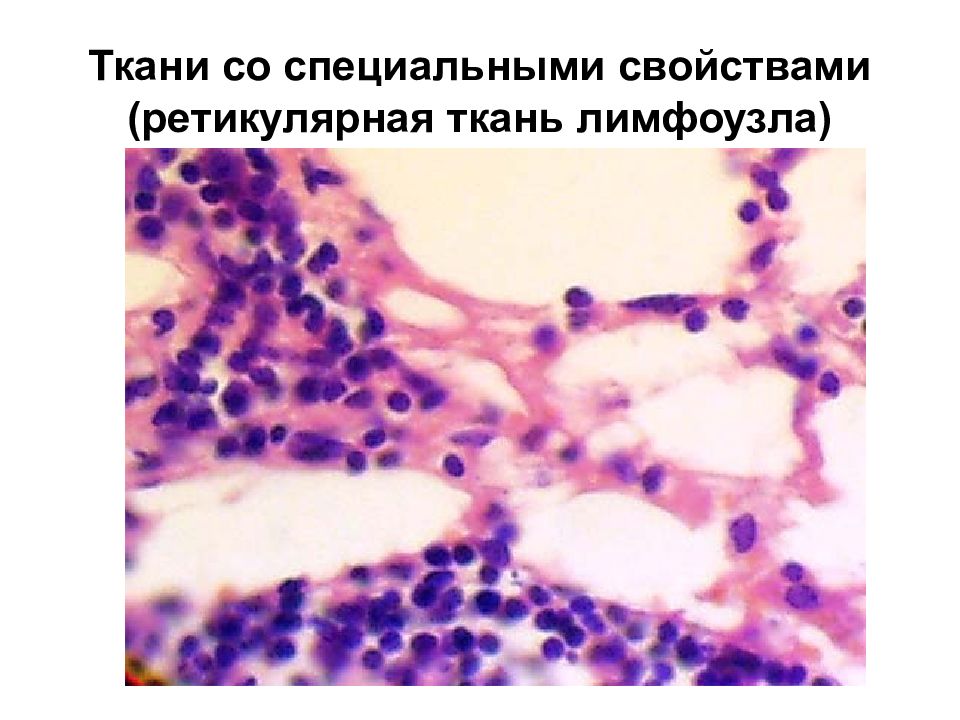 Ретикулярная ткань. Ретикулярная ткань лимфатического узла синцитий Макрофаг. Ретикулярная ткань гистология. Ретикулярная ткань лимфатического узла препарат гистология. Ретикулярная ткань лимфатического узла препарат.