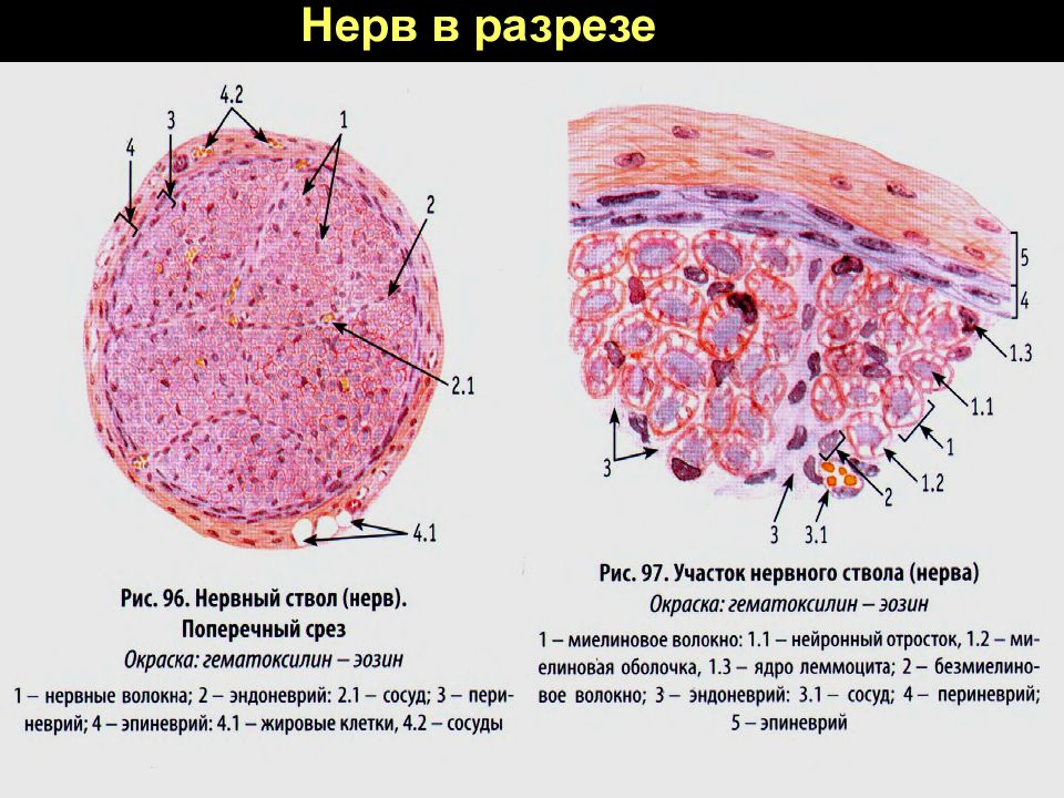 Нервный ствол. Поперечный срез нерва препарат. Поперечный срез нерва гистология. Поперечный срез периферического нерва. Поперечный срез периферического нерва препарат.