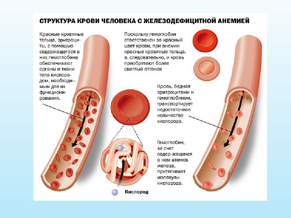 Заболевания крови у беременных презентация