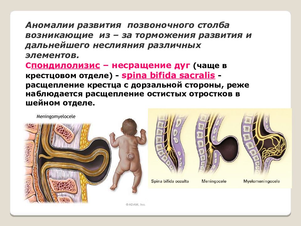 Развитие позвоночного столба. Пороки развития позвоночника. Аномалии развития позвонков. Аномалии переходных отделов позвоночного столба. Аномалия развития позвонка.