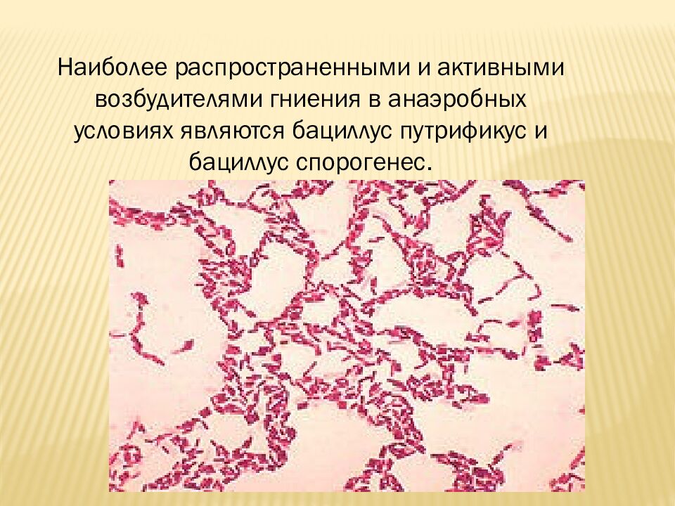 презентация: Тема: «ВИДЫ БАКТЕРИЙ»