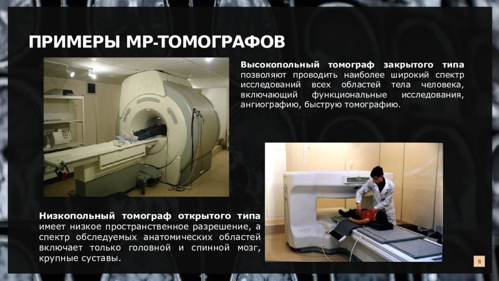 Работа мрт. Мрт аз-300 (низкопольный) – томограф открытого типа. Магнитно-резонансная томография мрт презентация. Магнитно-резонансный томограф аз-300. Функциональная мрт презентация.