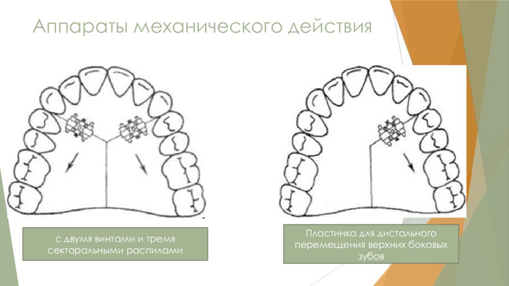 Ортодонтические аппараты механического действия презентация