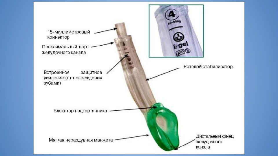 Трудные дыхательные пути в анестезиологической практике. Difficult Airway