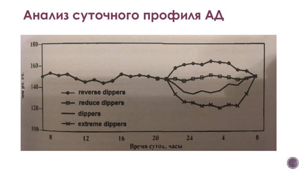 Исследование суточного. Суточный профиль ад. Профили кривых по суточному мониторированию. Циркадный профиль сохранен. Анализ ежедневных помех времени.