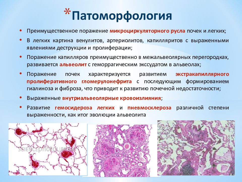 Васкулиты патанатомия презентация