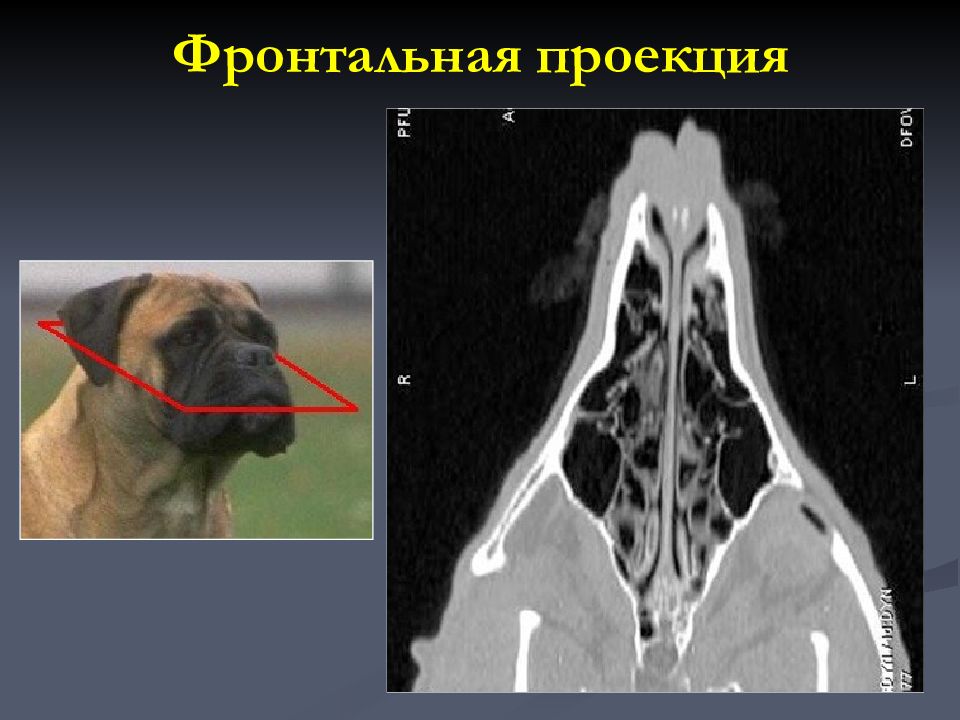 Проекции кт. Фронтальная проекция кт. Проекции компьютерной томографии. Проекции томограммы.