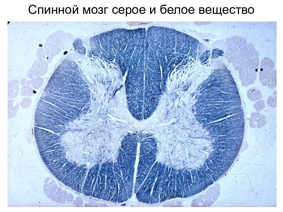 Спинной мозг серое. Серое и белое вещество спинного мозга. Серое вещество и белое вещество спинного мозга. Спинной мозг серое и белое. Серое вещество спинного мозга в форме.