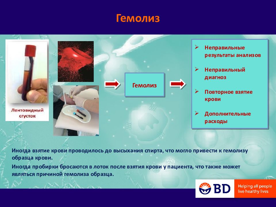 Гемолиз в пробирке причины. Гемолиз в анализе крови. Анализ крови на гемолизис. Факторы приводящие к гемолизу эритроцитов. Кровь после взятия анализа