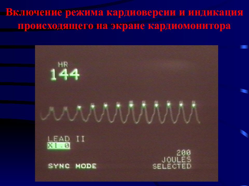 Электроимпульсная терапия презентация