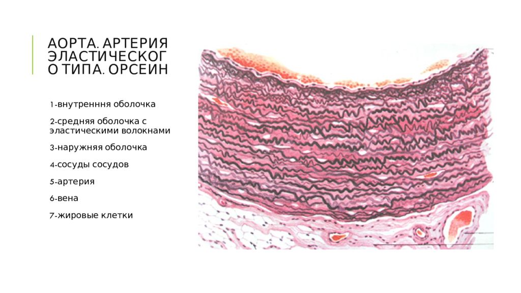 Стенки аорты. Артерия эластического типа препарат гистология. Артерия эластического типа препарат гистология орсеин. Артерия эластического типа гистология. Артерия эластического типа аорта кошки.