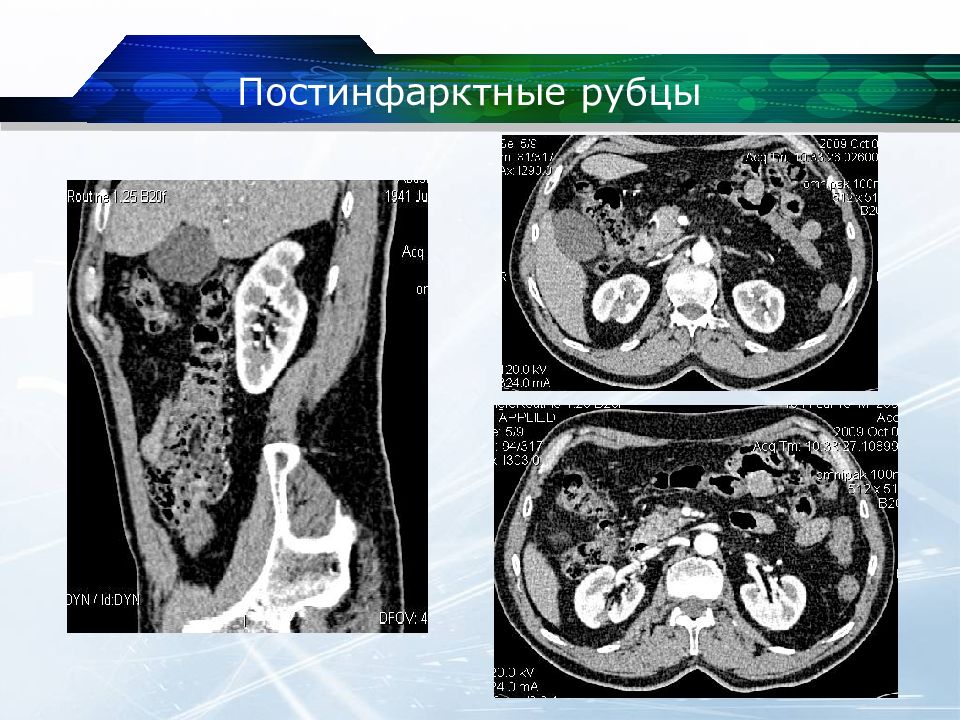 Кт почек презентация