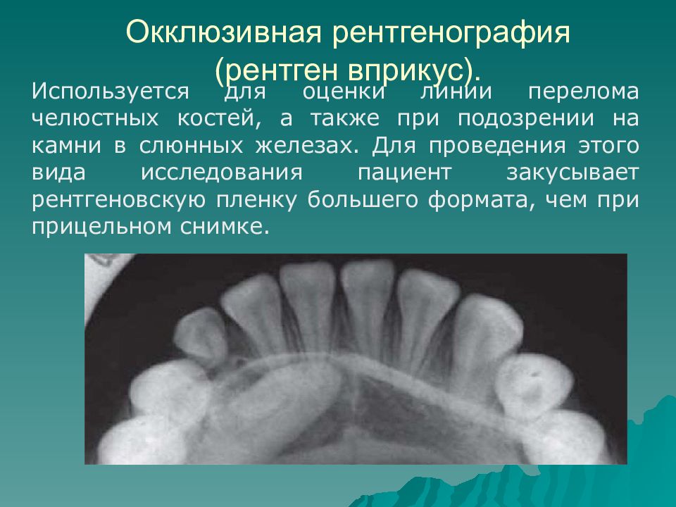 Укладки в рентгенологии в картинках и с описанием