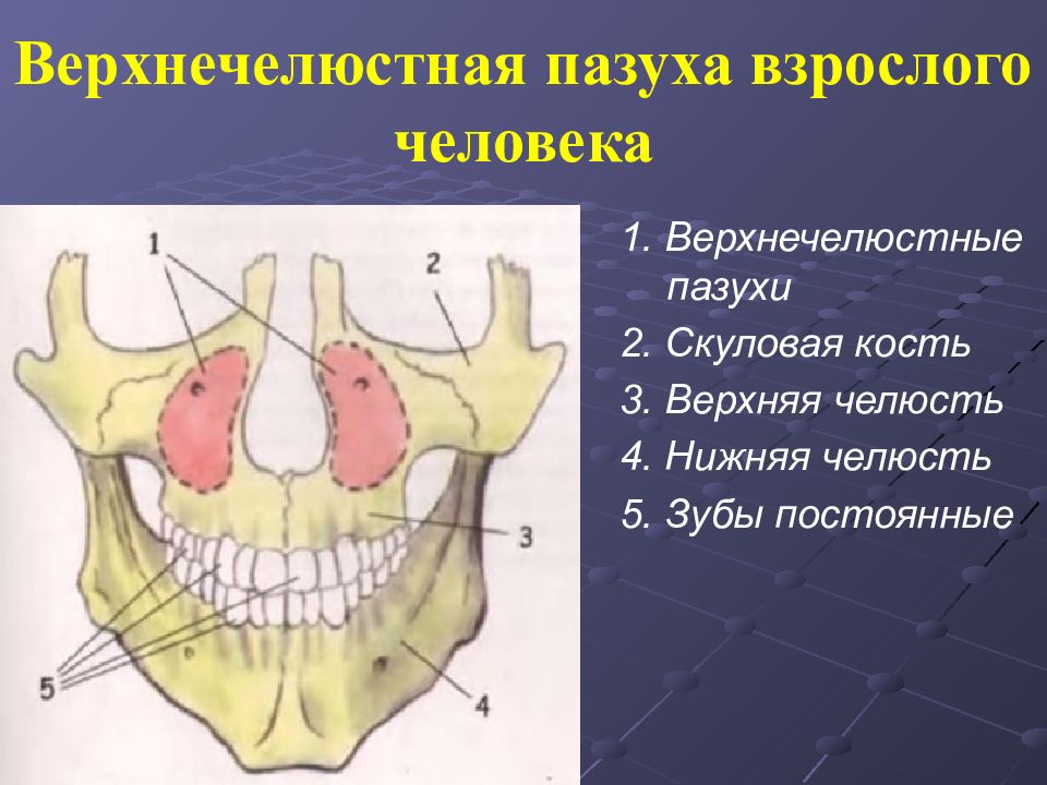 Левая верхнечелюстная пазуха. Топографическая анатомия верхнечелюстной пазухи. Стенки верхнечелюстной пазухи анатомия. Верхнечелюстная пазуха анатомия строение. Стенки пазухи верхней челюсти.