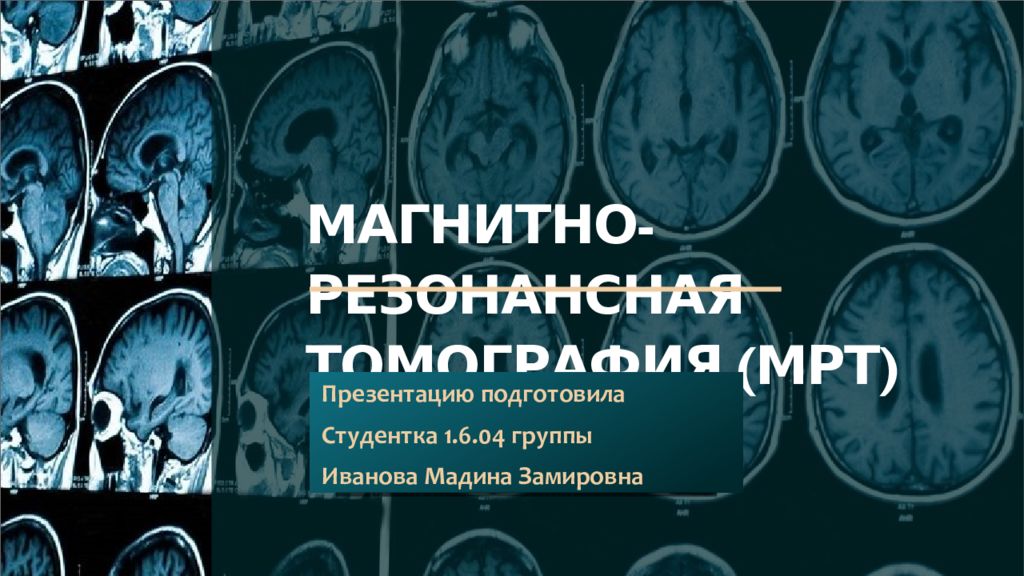Магнитно-резонансная томография (МРТ)