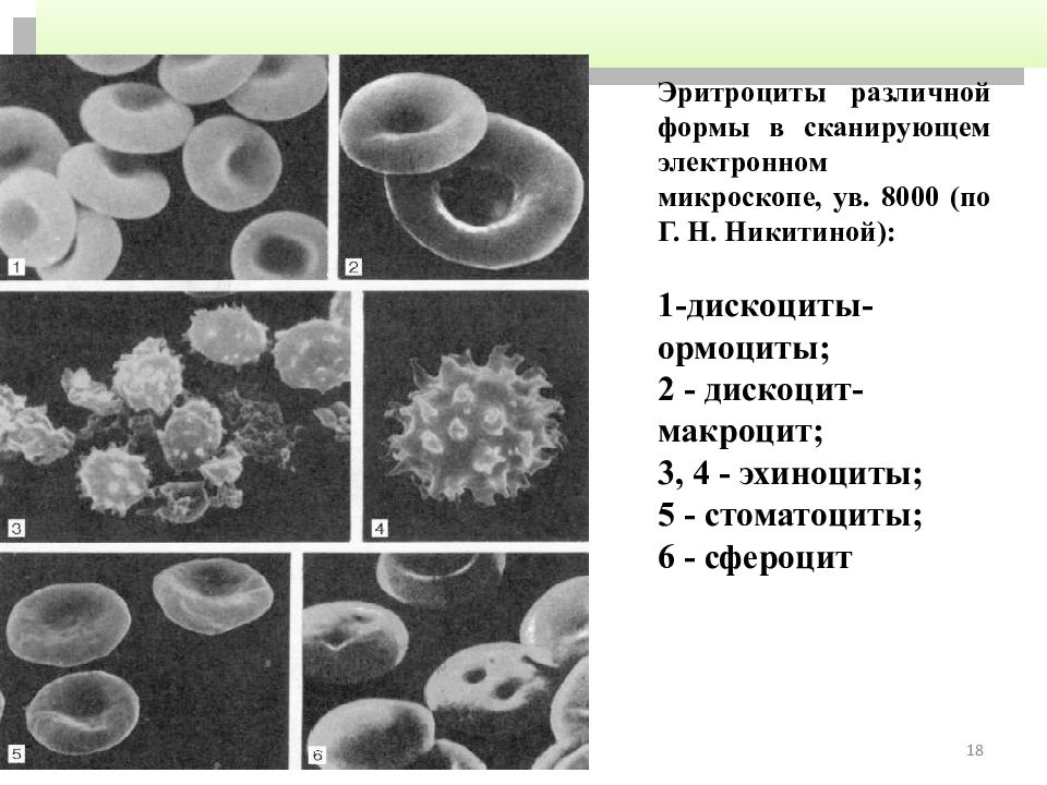 Макроциты. Эритроциты различной формы в сканирующем электронном микроскопе. Эритроциты разной формы. Эритроцит под электронный микроскоп. Формы эритроцитов в электронный микроскоп.