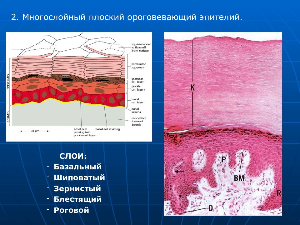 Многослойный плоский ороговевающий эпителий рисунок