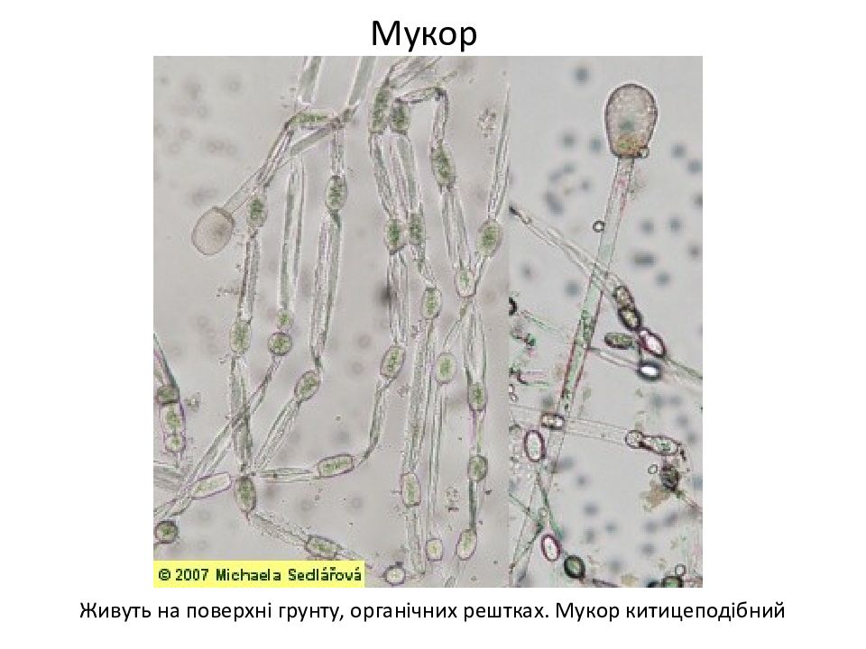 Ядра мукора. Мукор мицелий. Мукор колонии. Мицелий мукора под микроскопом. Строение плесени мукора под микроскопом.