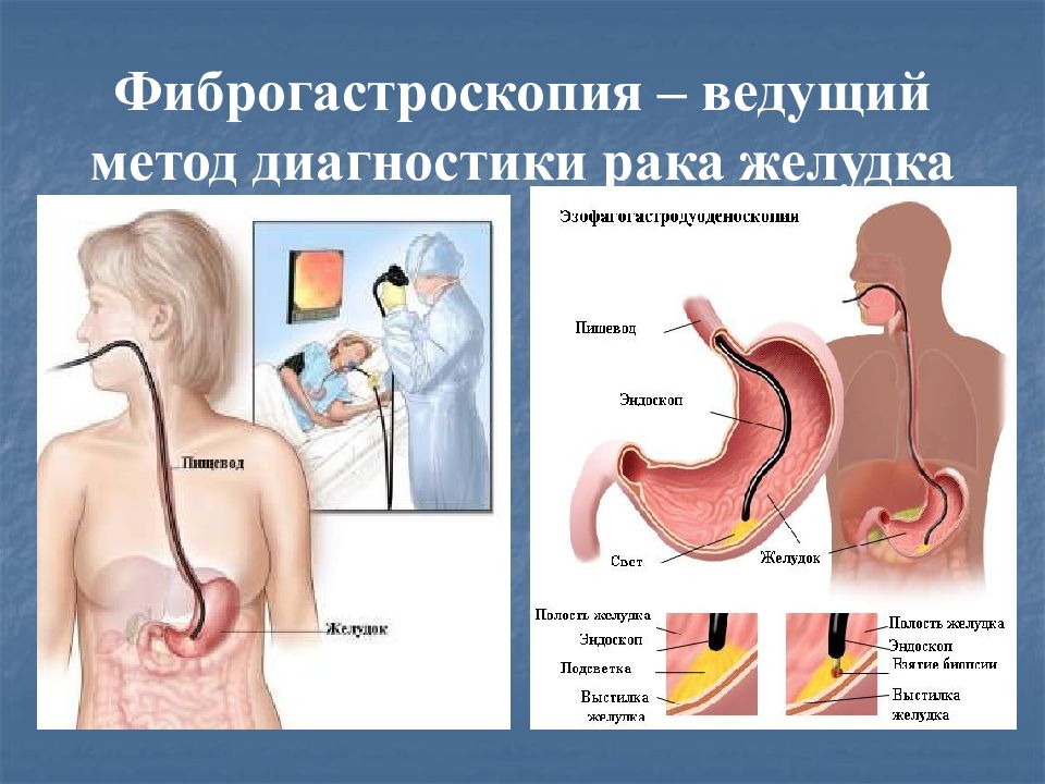 Заболевания пищевода хирургия презентация