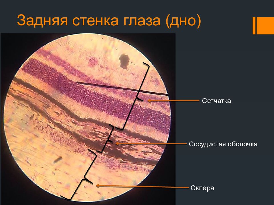 Общий план строения глазного яблока гистология