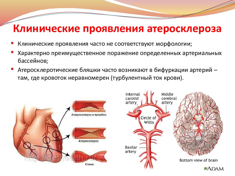 Атеросклероз — презентация