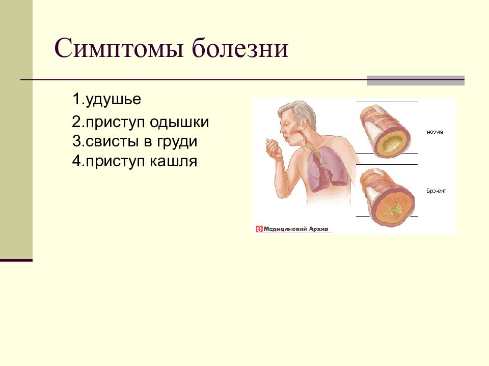 Признаки удушья. Симптомы удушья. Признаки и симптомы удушья. Приступ удушья симптомы. Признаки и симптомы удушения.