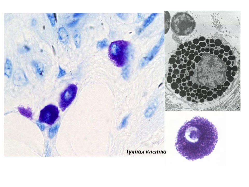 Тучные клетки. Гистологический препарат тучные клетки. Тучные клетки гистология. Тучные клетки гистология препарат. Тучные клетки Эрлиха микроскоп.
