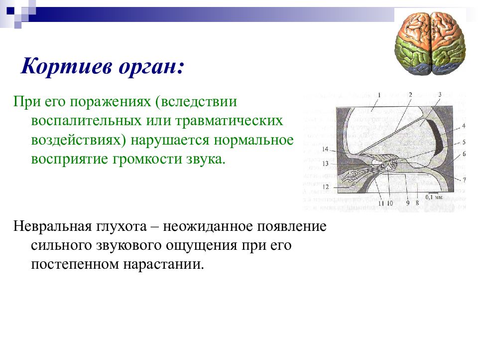 Сенсорные слуховые расстройства презентация