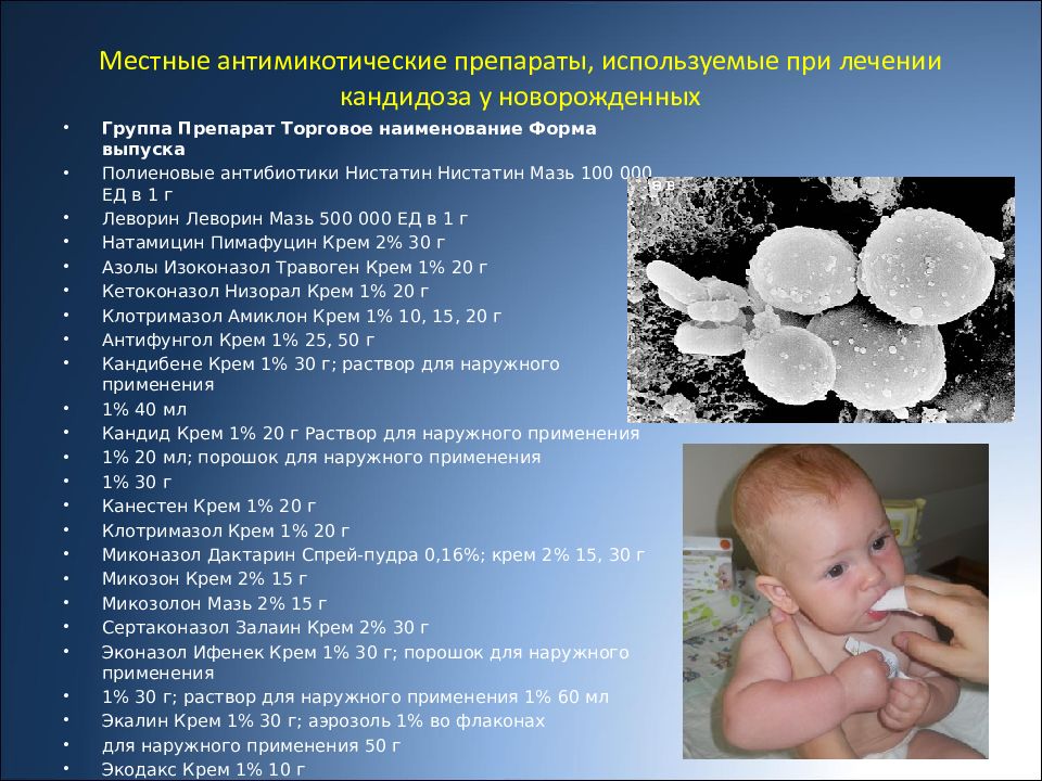 Можно ли детей лечить. Инфекции новорожденных. Инфекции у новорожденных детей. Внутриутробные инфекции у новорожденных.