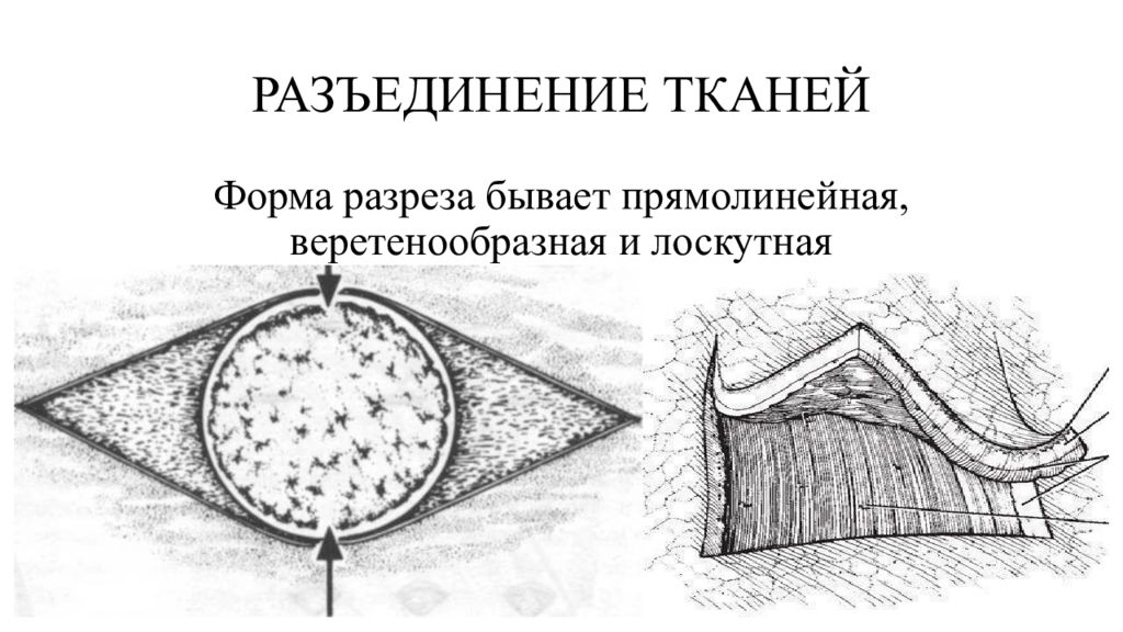 Прямолинейные разрезы. Линейный разрез мягких тканей Ветеринария. Виды разрезов мягких тканей Ветеринария линейный. Веретенообразный разрез мягких тканей. Виды разрезов мягких тканей.