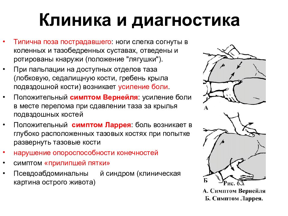 Симптом прилипшей пятки характерен. Синдром прилипшей пятки. Синдром прилипшей лопатки. Симптом "прилипшей пятки" возникает при переломе.