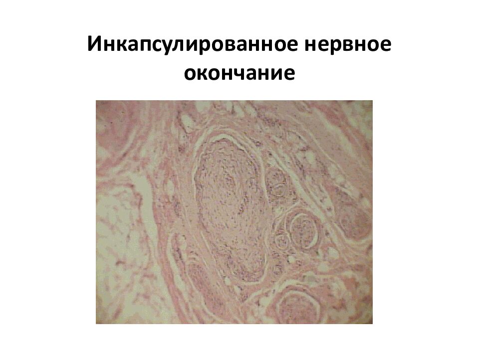 Инкапсулированное нервное окончание