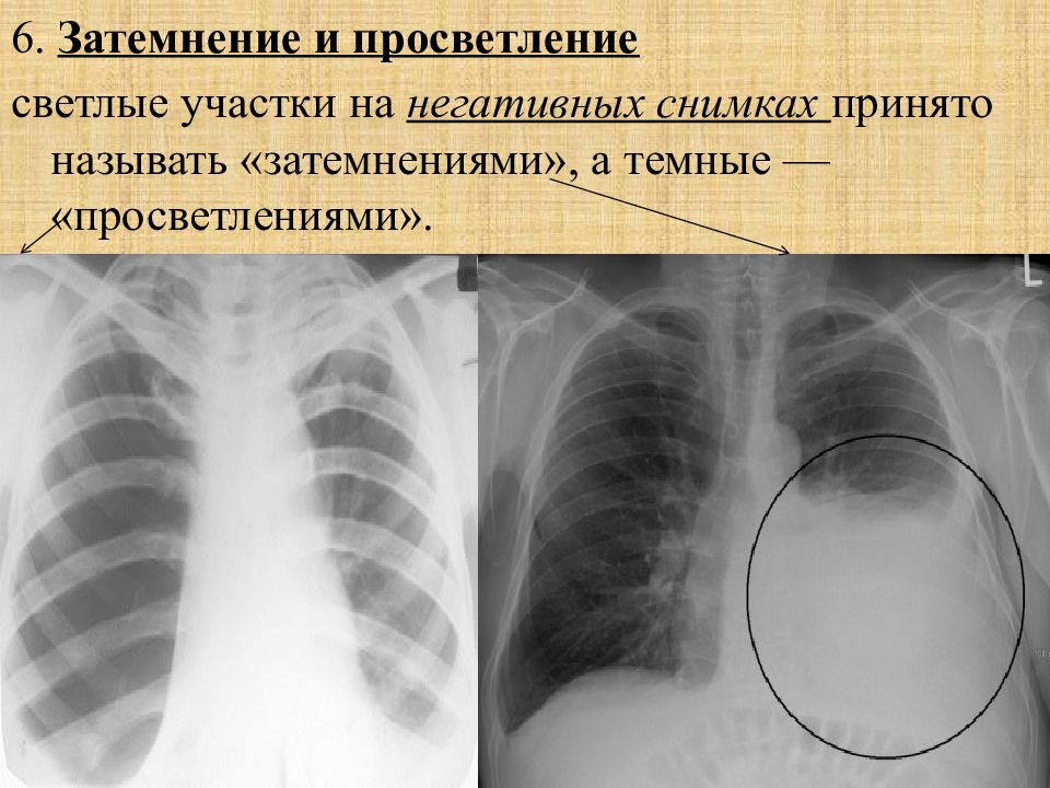 Рентгеновское изображение получают