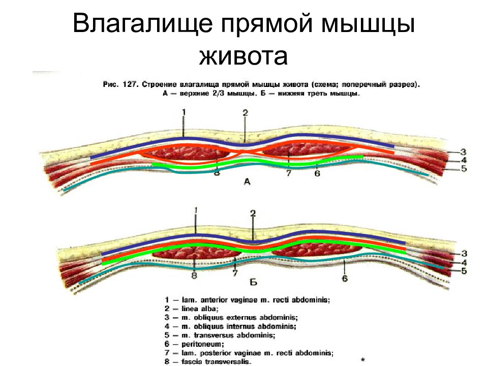 Топография брюшной стенки презентация