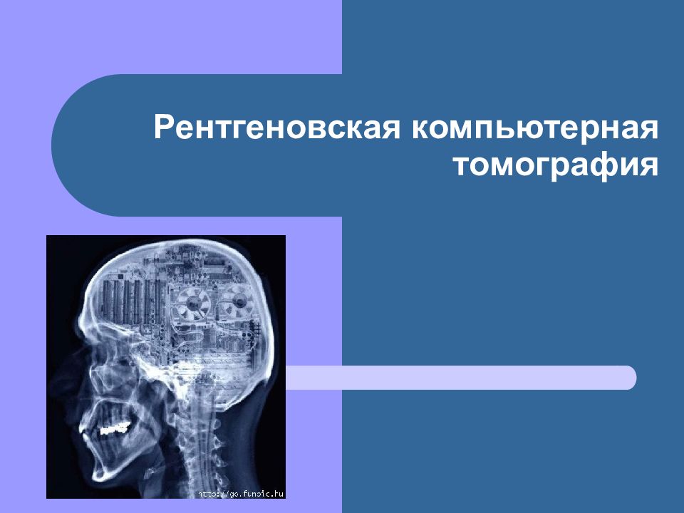 Рентгеновская компьютерная томография презентация