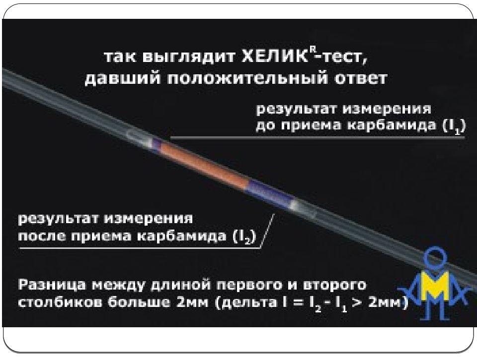 Хелик теста. Хелик тест. Тест система Хелик. Тест-система Хелик с индикаторной трубкой. Индикаторные трубки Хелик.