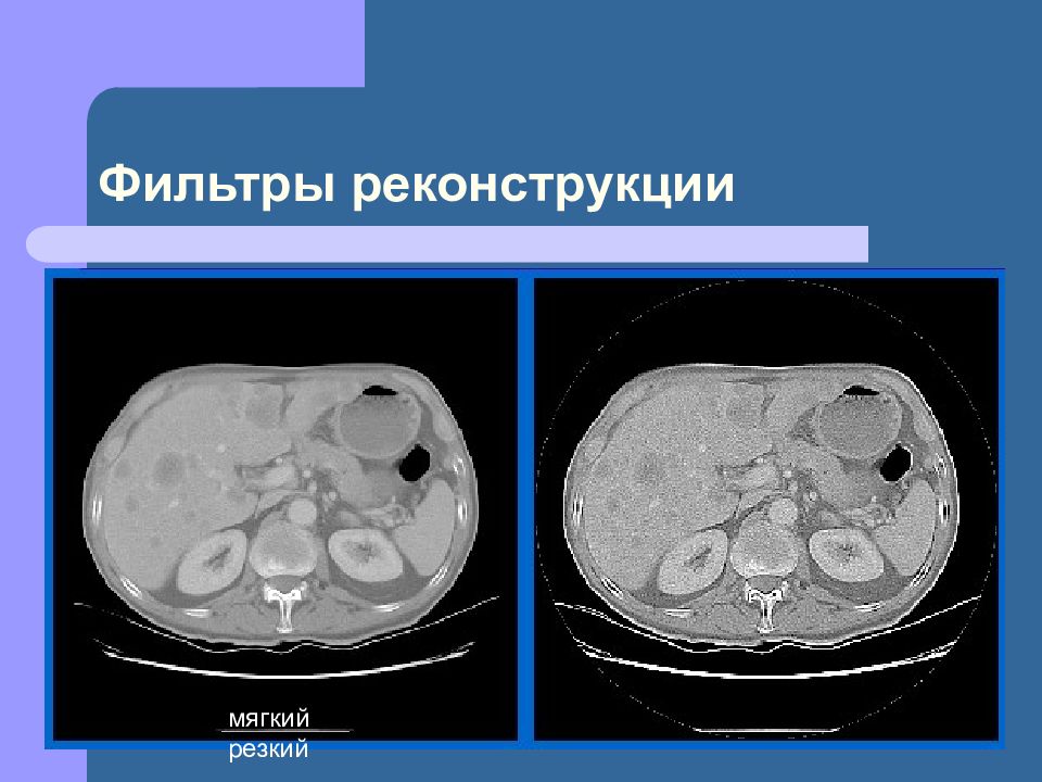 Презентация на тему компьютерная томография