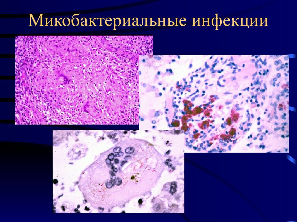 Воспаление патанатомия презентация