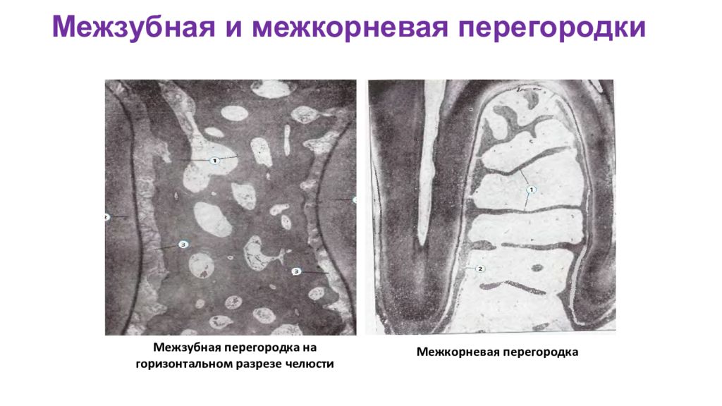 Надкостница зубы челюсти. Межкорневая перегородка зуба. Костная перегородка зуба. Костная перегородка зуба. Костная перегородка зуба.